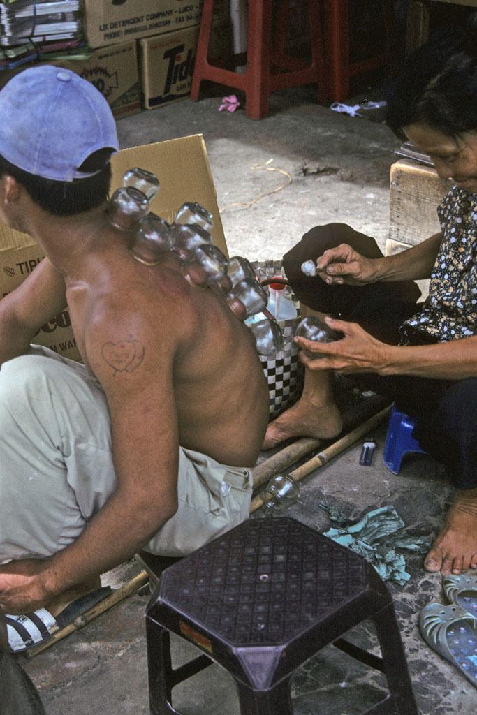 <img typeof="foaf:Image" src="http://statelibrarync.org/learnnc/sites/default/files/images/vietnam_157.jpg" width="683" height="1024" alt="Young man receiving moxibustion, Ho Chi Minh City" title="Young man receiving moxibustion, Ho Chi Minh City" /> <img typeof="foaf:Image" src="http://statelibrarync.org/learnnc/sites/default/files/images/vietnam_157.jpg" width="683" height="1024" alt="Young man receiving moxibustion, Ho Chi Minh City" title="Young man receiving moxibustion, Ho Chi Minh City" />