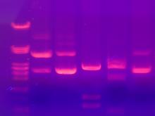 <img typeof="foaf:Image" src="http://statelibrarync.org/learnnc/sites/default/files/images/gel_electrophoresis.jpg" width="1600" height="1200" alt="Gel electrophoresis" title="Gel electrophoresis" />